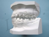 DAMON SPLINT